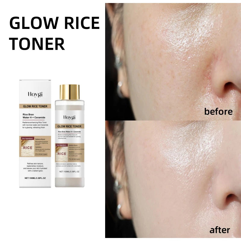 Peel Shot Ampule Set Rice Toner Moisturizing Facial Essence Glowing Skin Water-oil Balancing Essence Revitalizing Skin Dullness