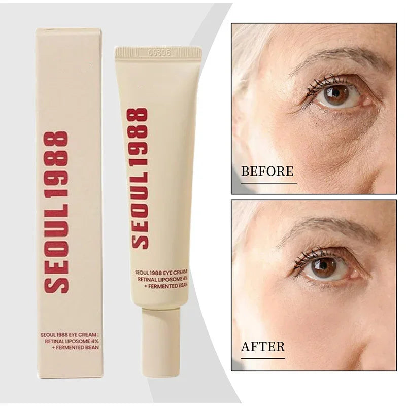 New Seoul 1988 Eye Cream 4% Retinol Liposome Facial Treatment Cream Lightens Fine Lines Dark Circles Reduces Puffiness Eye Cream